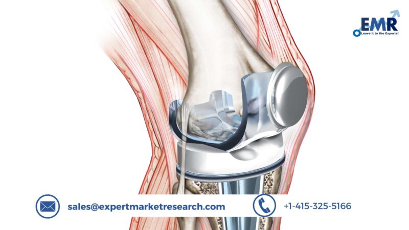 Global Knee Replacement Market Size, Forecast 2023-2028 | EMR Inc.